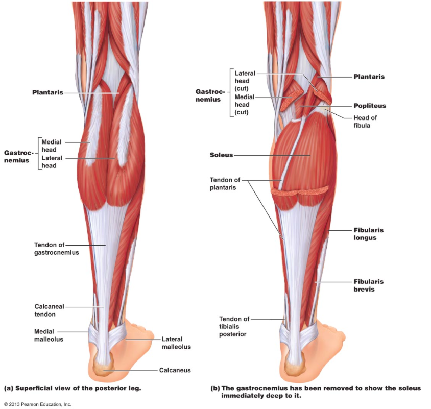 TENDONS: tricky or treasure?