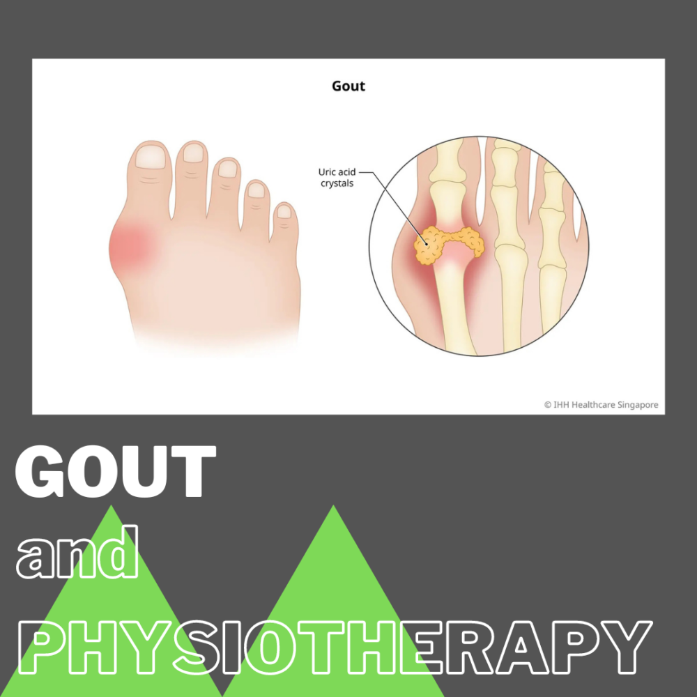 Gout and Physiotherapy